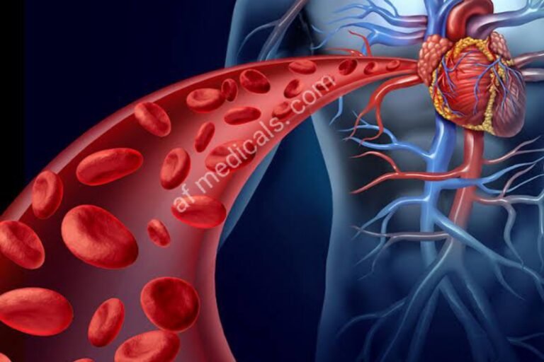 Acute Coronary Syndrome