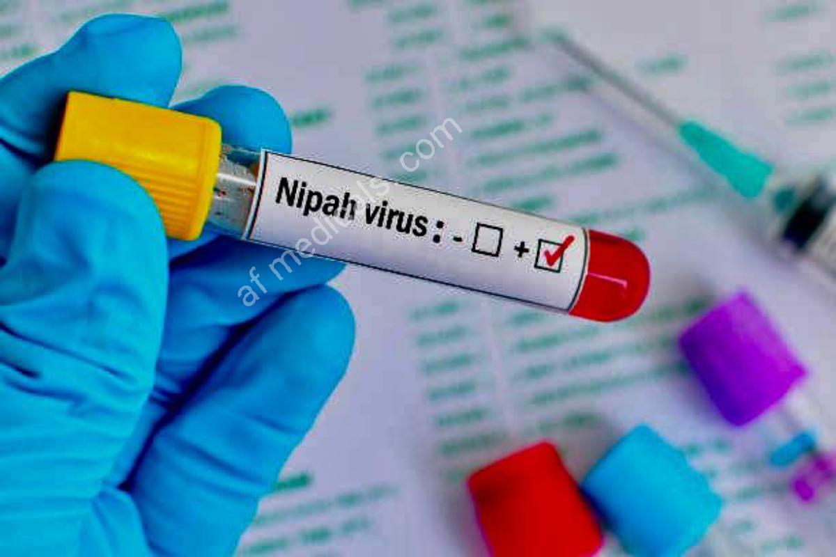 Nipah Virus