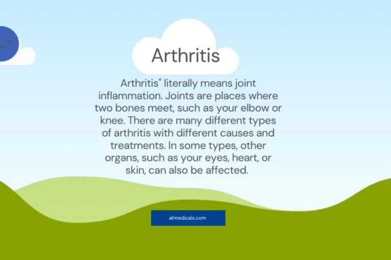 Arthritis