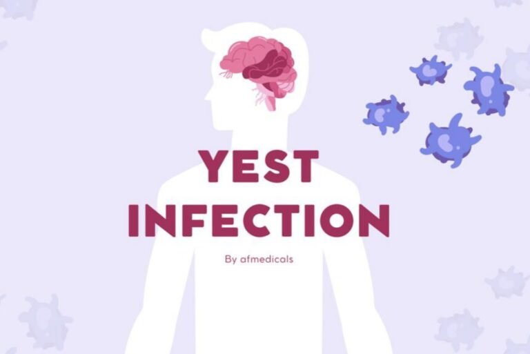 Yeast Infection