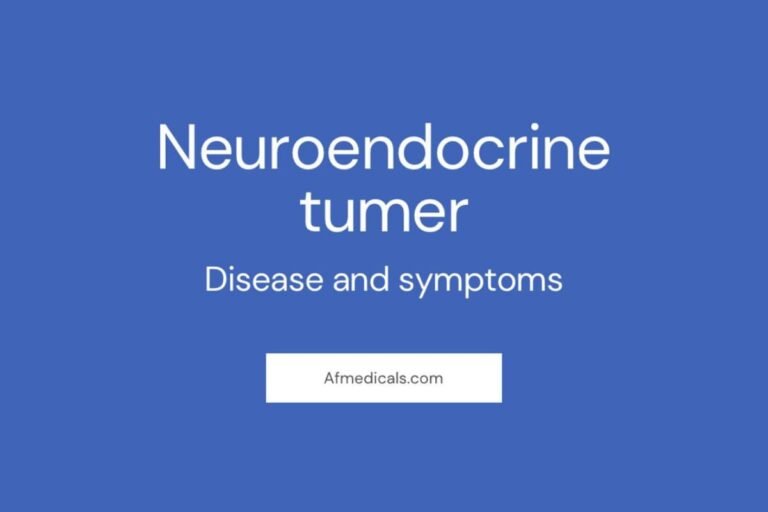 Neuroendocrine Tumors