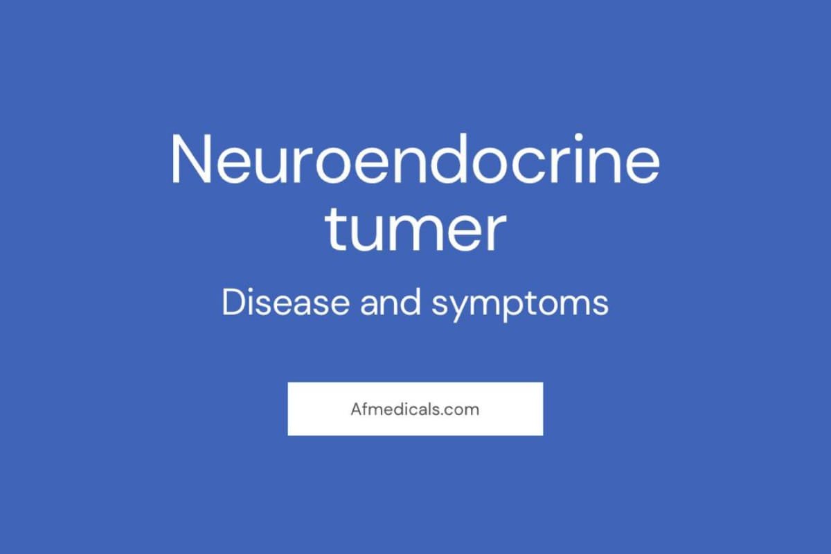 Neuroendocrine Tumors